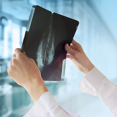 Doktor mit Mammografie